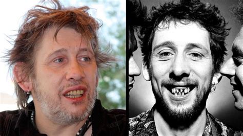 Shane Macgowan No Teeth | Hot Sex Picture