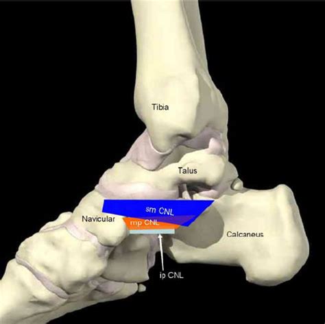 Diagram of the medial aspect of the ankle and foot showing the three... | Download Scientific ...