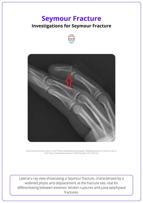 Seymour Fracture: Causes, Presentation, & Treatment