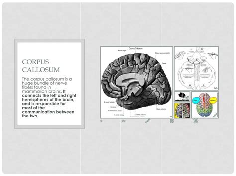 PPT - Split-brain surgery & the brain hemispheres PowerPoint ...