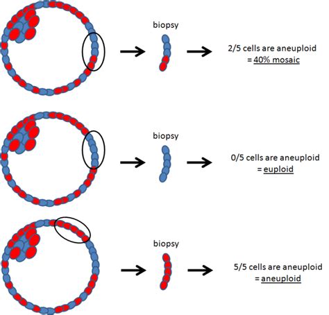 Complete guide to PGS Testing (PGT-A) in IVF for embryo screening- Remembryo