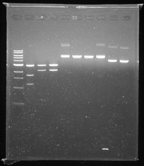 biochemistry - How do I interpret the results of this DNA gel ...