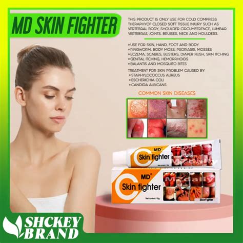 MD Skin Fighter Cream for Skin Allergies or Fungis | Lazada PH