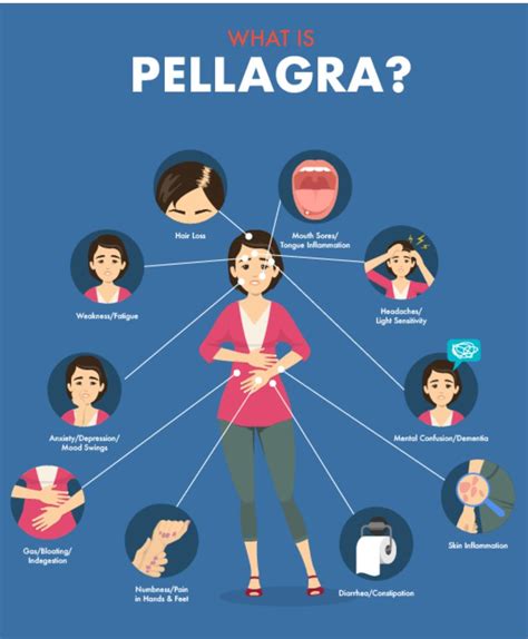 Pellagra, Gluten, & Vitamin B3 Deficiency - Gluten Free Society