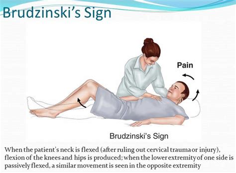 Kernig sign, Brudzinski sign, how to perform Kernig and Brudzinski test