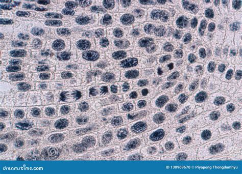 Metaphase Of An Onion Root Tip Cell Under The Microscope Royalty-Free Stock Photography ...