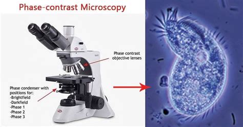 Phase contrast Microscopy- definition, principle, parts, uses | Microscopy, Contrast, High ...