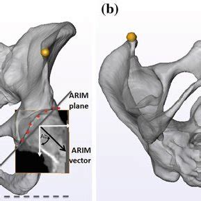 Pelvic Anatomy Asis - Human Anatomy