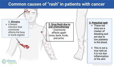 Skin Rash | ChemoExperts