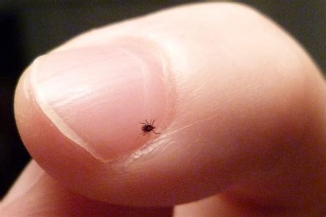 It’s hunting season–ticks hunting us « All In