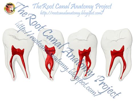 The Root Canal Anatomy Project: Mandibular First Molar