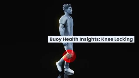 Knee Locking: Common Causes and When to Seek Medical Care | BuoyHealth.com - YouTube