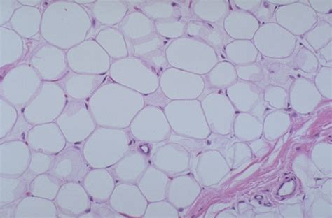 Normal Histology