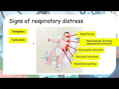 subcostal vs intercostal retractions