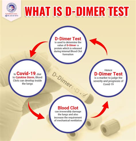 D-Dimer Test - B.P. Poddar Hospital