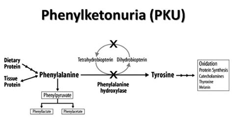 Genetic Brain Disorders as related to Phenylketonuria - Pictures