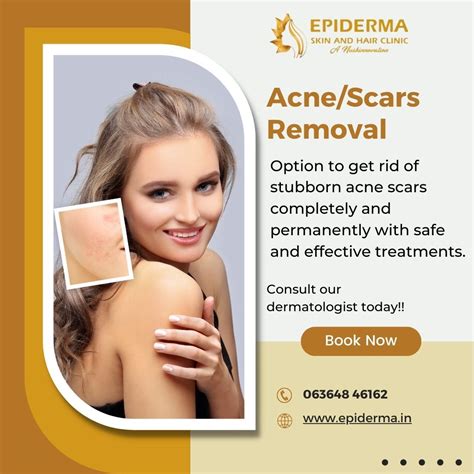 Acne or Scars Removal | Best Skin Clinic in Jayanagar, Bangalore ...