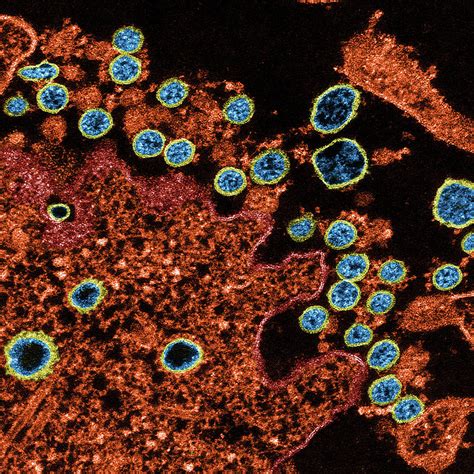 Sars-cov-2, Covid-19 Virus, Tem Photograph by Science Source | Fine Art America