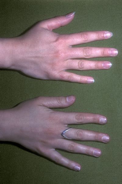 Colloidal silver—science or fraud?- Clinical Advisor