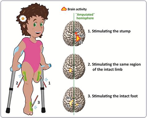 Neuroplasticity: The Brain Changes Over Time! · Frontiers for Young Minds