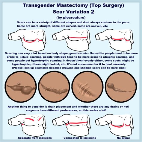 Sylar 🔪 on Twitter | Body reference, Surgery scars, Anatomy reference