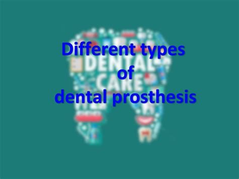 Different types of dental prosthesis