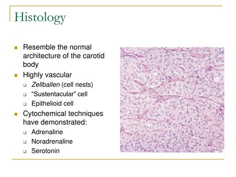 PPT - Carotid Body Tumour PowerPoint Presentation, free download - ID ...