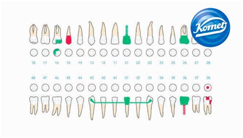 ¿En qué consiste un odontograma dental? - Suministros Antón