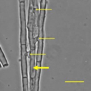 Cytoplasmic bridges (thin arrows) connect one hypha (thick arrow) to 3... | Download Scientific ...