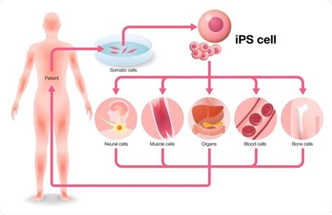 Induced Pluripotent Stem (iPS) Cells in Medicine and Research