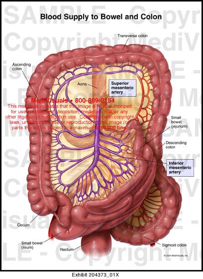 Blood Supply to Bowel and Colon Medical Illustration Medivisuals