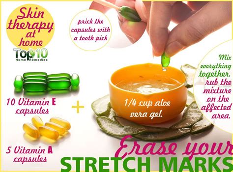 How to Get Rid of Stretch Marks Fast | Top 10 Home Remedies