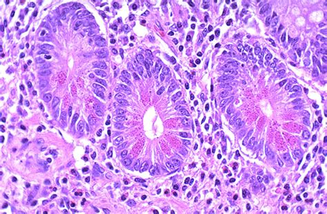 Normal Histology