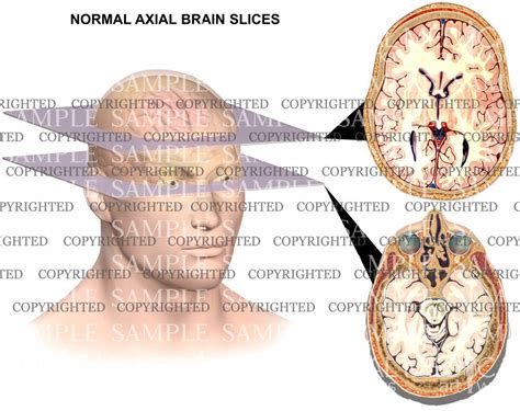 Axial Brain Anatomy