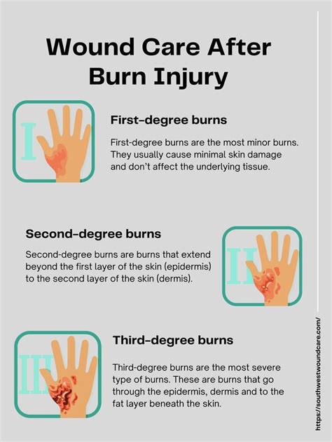 Wound Care After Burn Injury, Types, Symptoms, and Treatments | Burn injury, Burn wound care ...