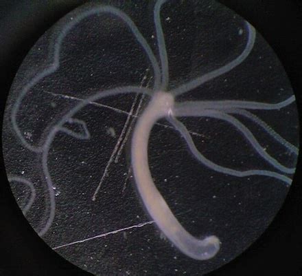 Hydra Definition, Nervous System & Reproduction | Study.com