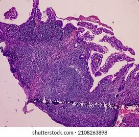 243 Ileum Histology Images, Stock Photos & Vectors | Shutterstock