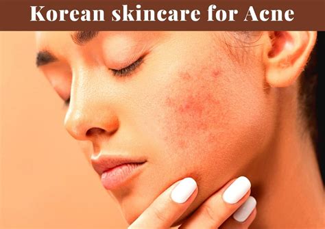 I Reviewed 8 Amazing Korean Skincare Products For Acne 2023 - Korea Truly