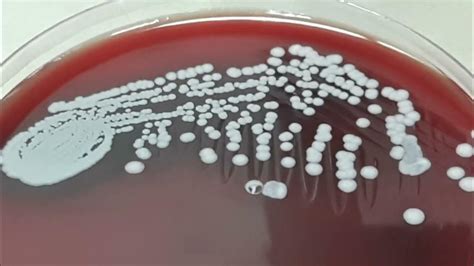 Staphylococcus epidermidis Colony morphology on Blood agar - YouTube