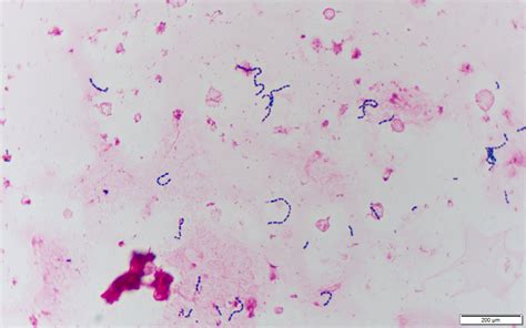 Peptostreptococcus micros〔口腔内嫌気性菌〕 | グラム染色: Gram Stain