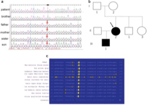 LMNA gene analysis in the pedigree. (a). Genetic analysis of the LMNA... | Download Scientific ...