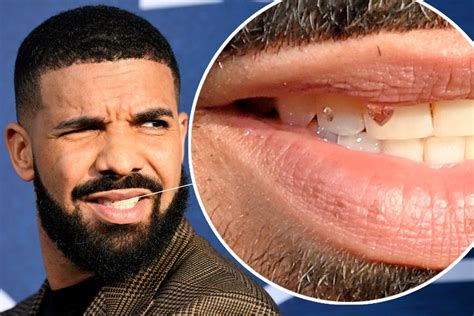 Drake has diamonds in his teeth and more star snaps | Page Six