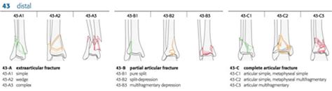 Distal Fibula Fracture Classification