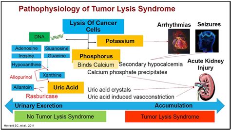 Tumor lysis syndrome causes, symptoms, criteria, treatment & prognosis