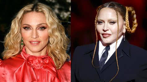 What Did Madonna Do to Her Face? Her Before and After Photo, Explained