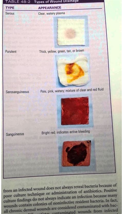 Types of wound drainage | Nurse practitioner programs, Psychiatric nurse practitioner, Wound ...