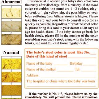 neonatal cholestasis an update medcrave online - biliary disease stool ...