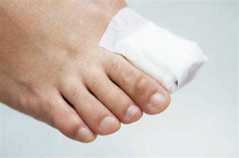 An Overview of Common Toenail Problems