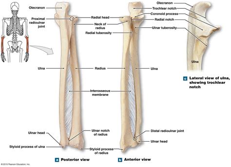 The right radius and ulna | Diagnostic imaging, Anatomy bones, Medical anatomy