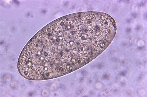 Parasitology 101: Fasciolopsis buski